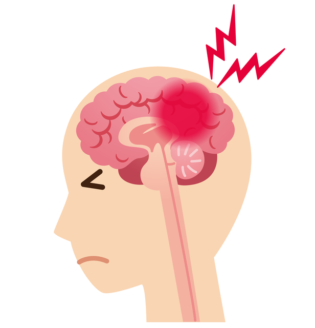 二次性頭痛　原因　特徴